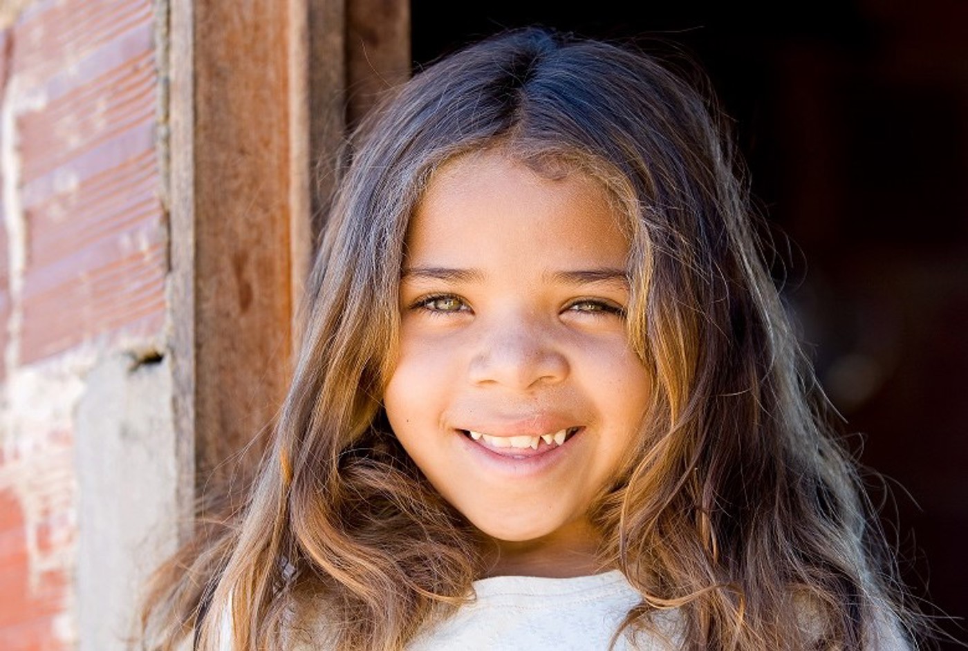 Danila, patient Brazil, after