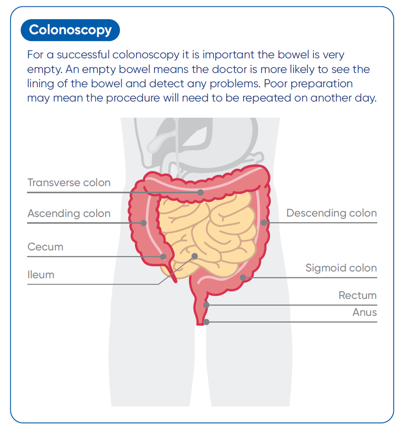 Colonoscopy