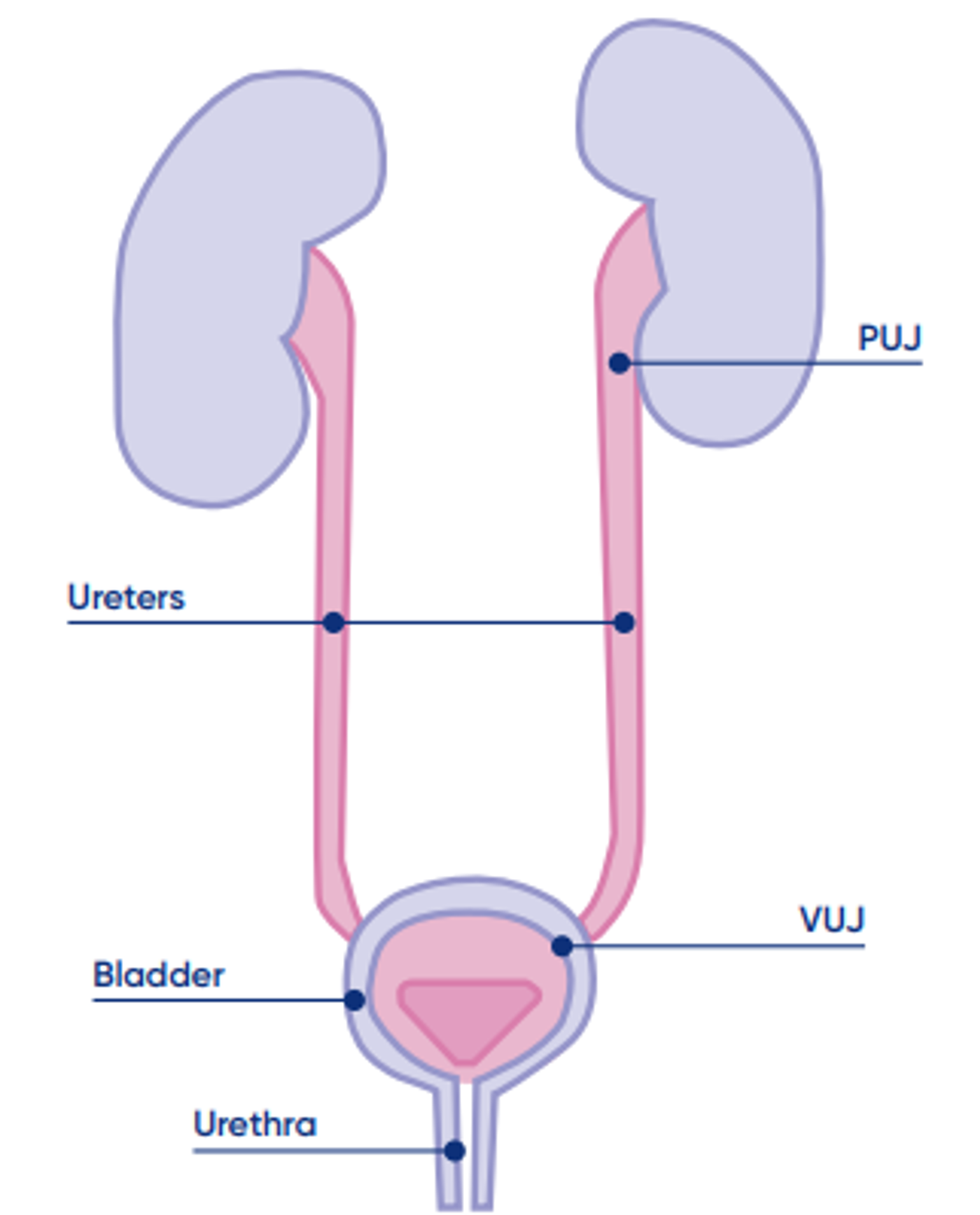 Kidney pelvis dilatation